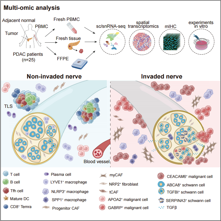 Cancer Cell | 张泽民团队及合作者揭示胰腺导管腺癌发生神经束侵袭转移的细胞及分子机制